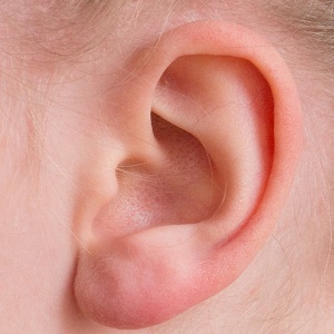 Is There Any Way to Fix Uneven Ears?